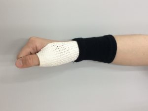 腱鞘炎治療 専用装具|札幌西区琴似 てて整骨院